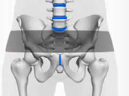 Skeleton model showing Serola sacroiliac belt’s 2-inch loop fitting perfectly over the SI joint